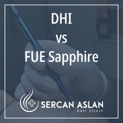dhi vs fue sapphire
